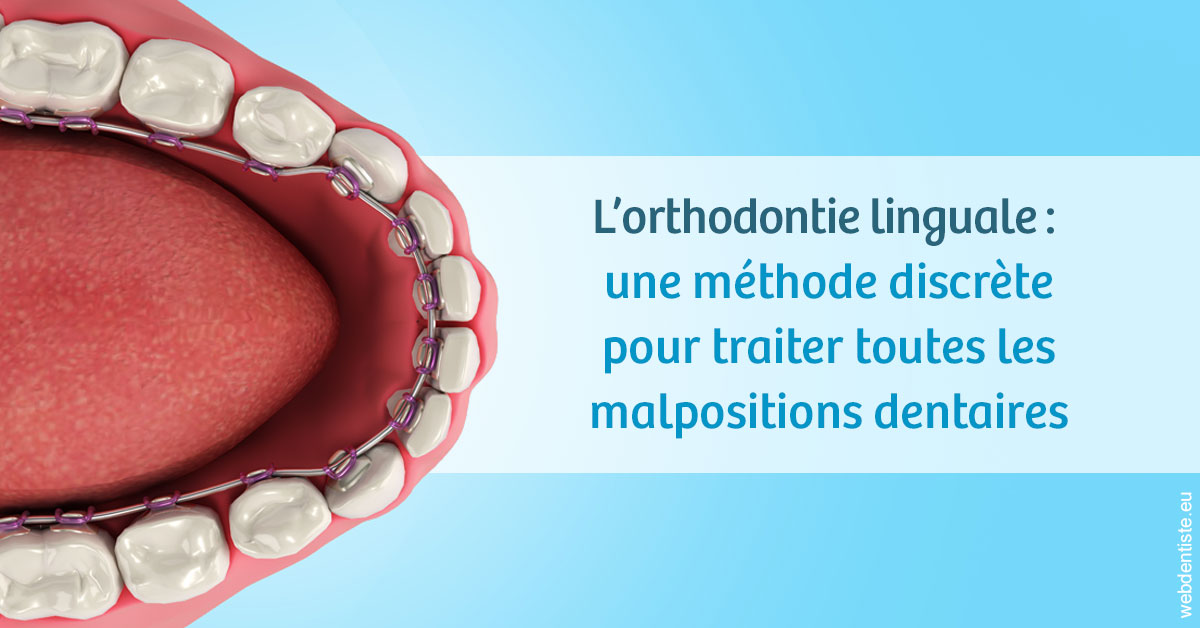 https://dr-masson-philippe.chirurgiens-dentistes.fr/L'orthodontie linguale 1