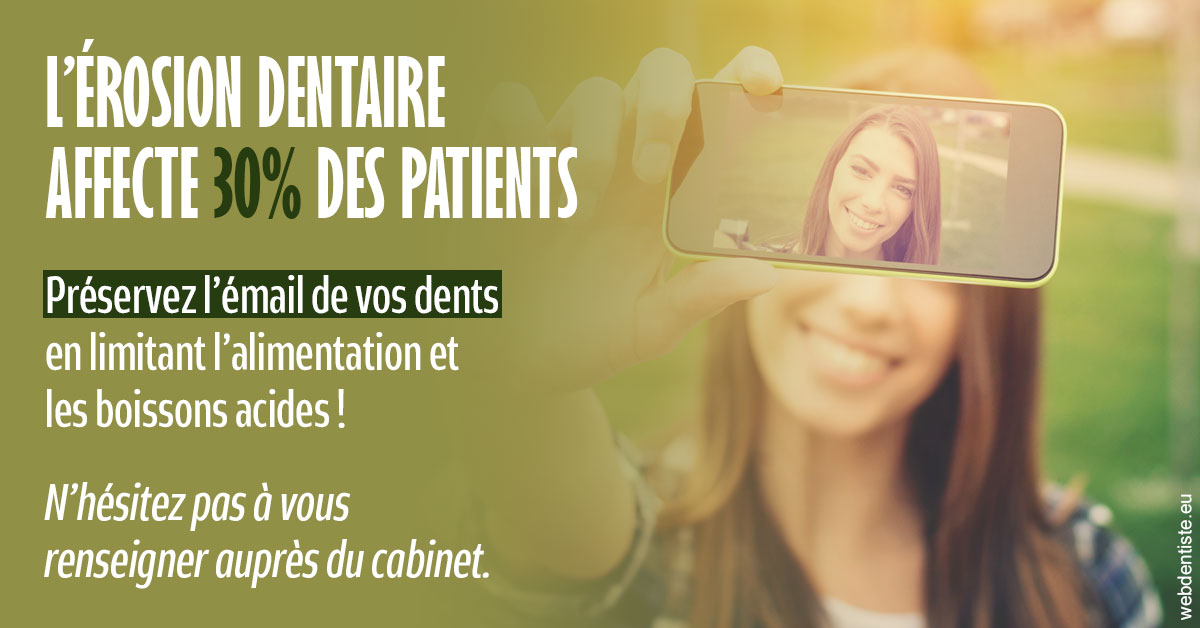 https://dr-masson-philippe.chirurgiens-dentistes.fr/L'érosion dentaire 1