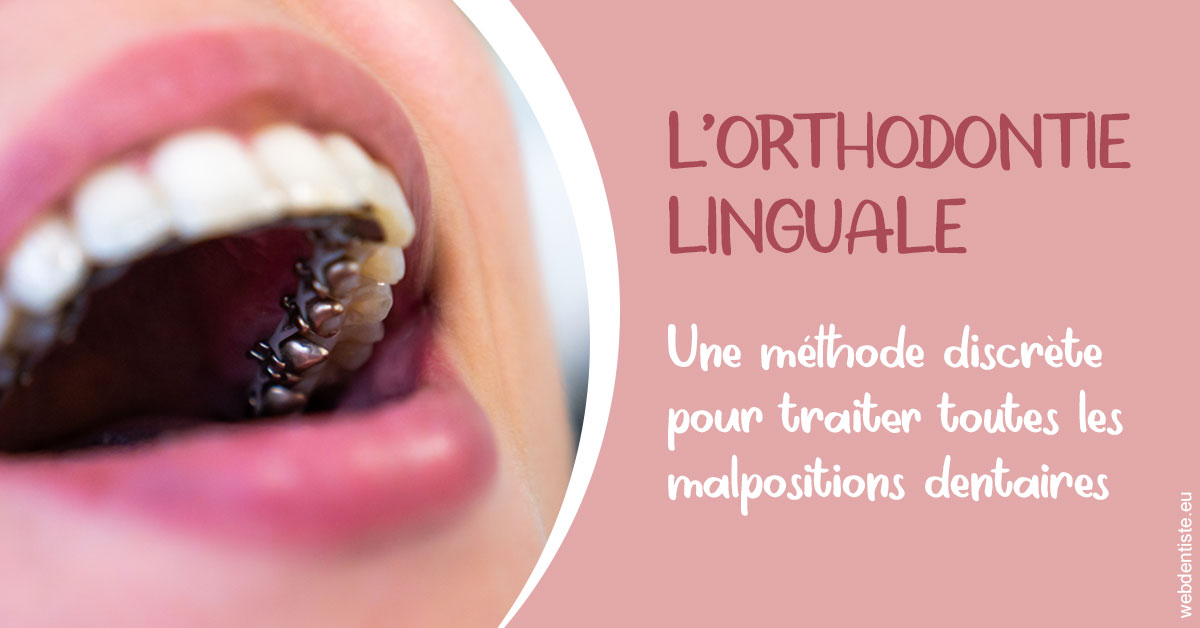 https://dr-masson-philippe.chirurgiens-dentistes.fr/L'orthodontie linguale 2
