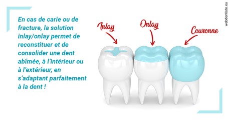 https://dr-masson-philippe.chirurgiens-dentistes.fr/L'INLAY ou l'ONLAY