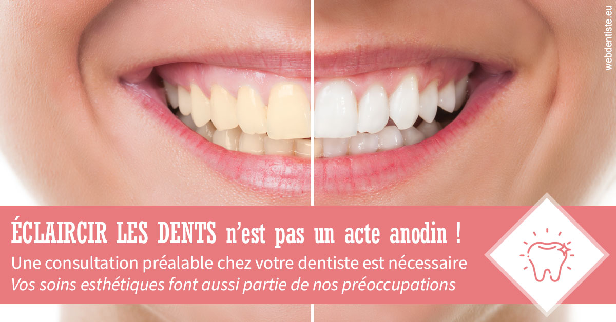 https://dr-masson-philippe.chirurgiens-dentistes.fr/Eclaircir les dents 1