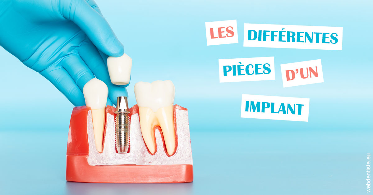 https://dr-masson-philippe.chirurgiens-dentistes.fr/Les différentes pièces d’un implant 2