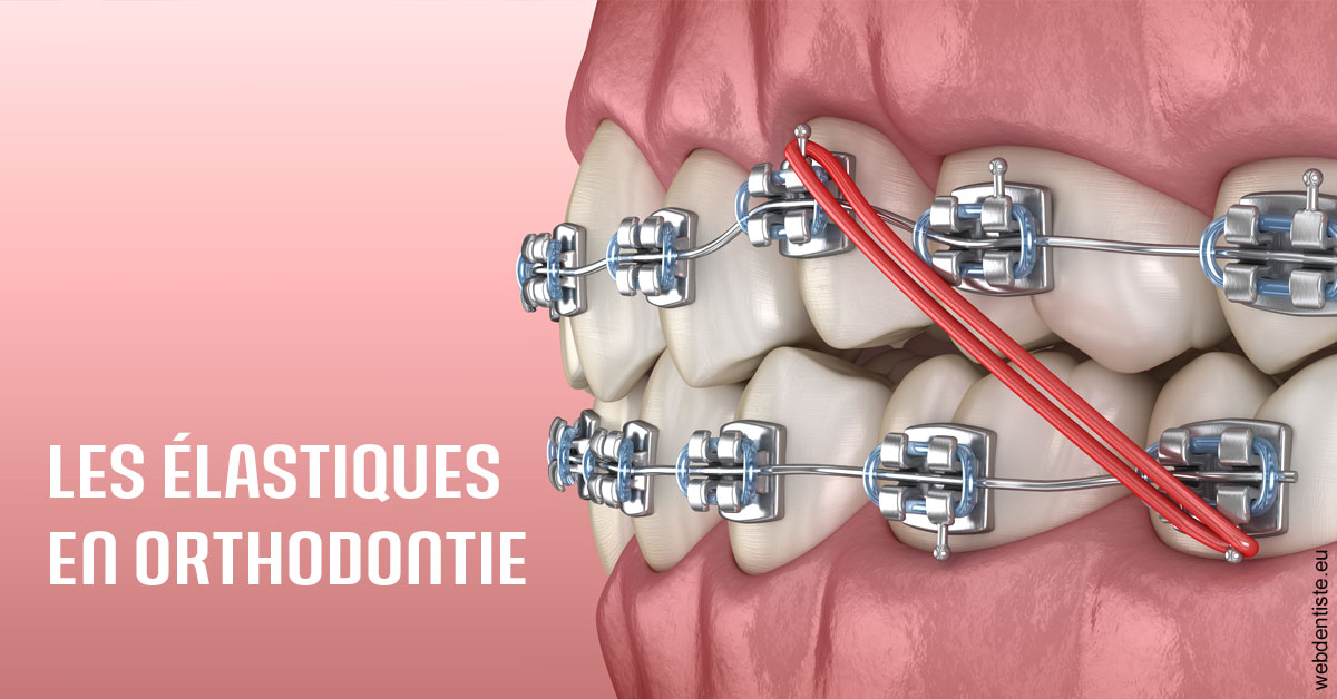 https://dr-masson-philippe.chirurgiens-dentistes.fr/Elastiques orthodontie 2