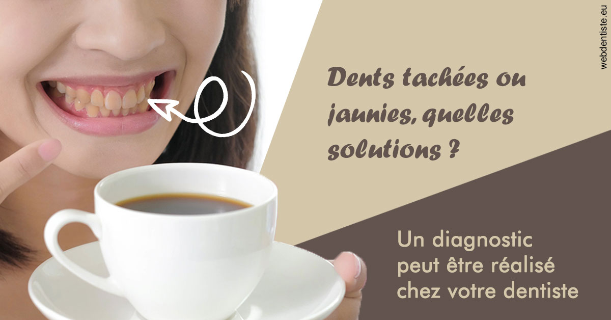 https://dr-masson-philippe.chirurgiens-dentistes.fr/Dents tachées 1