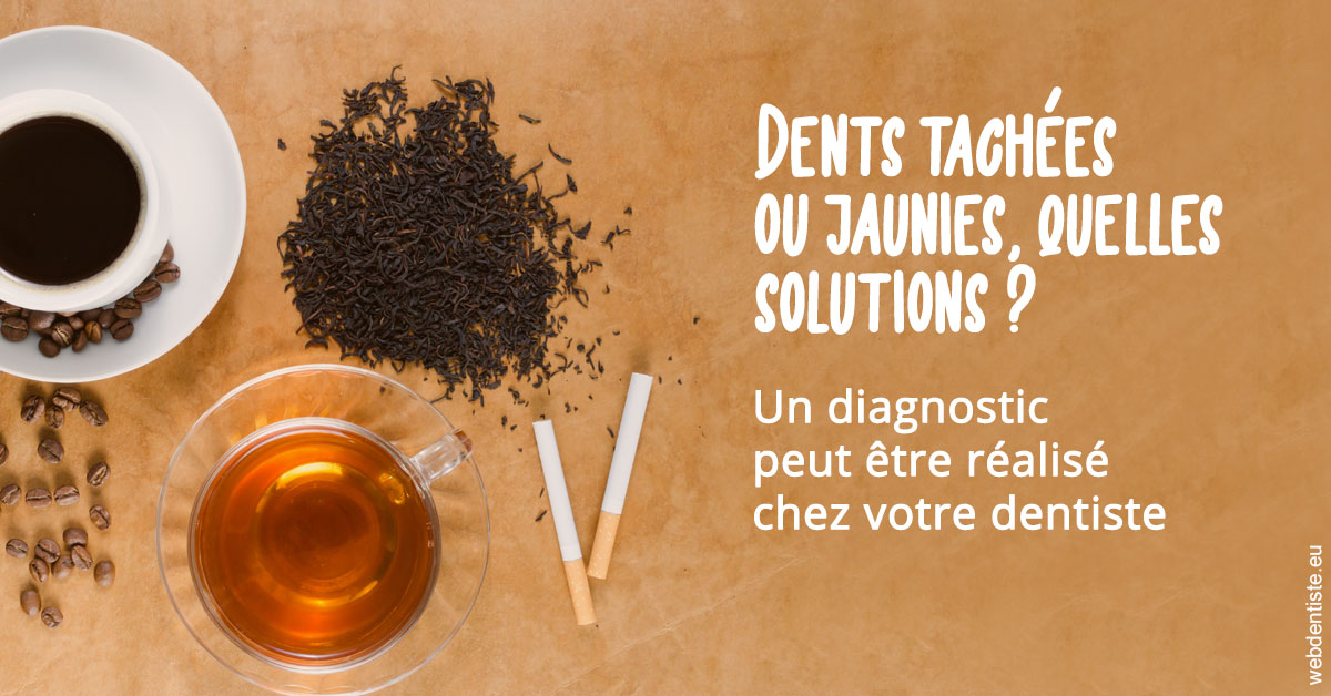 https://dr-masson-philippe.chirurgiens-dentistes.fr/Dents tachées 2