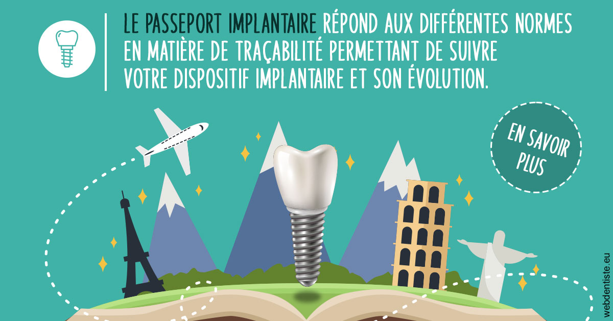 https://dr-masson-philippe.chirurgiens-dentistes.fr/Le passeport implantaire