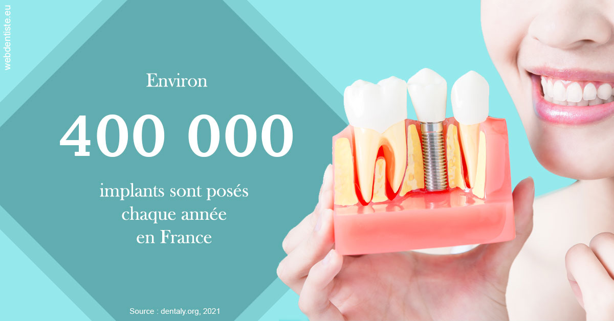 https://dr-masson-philippe.chirurgiens-dentistes.fr/Pose d'implants en France 2